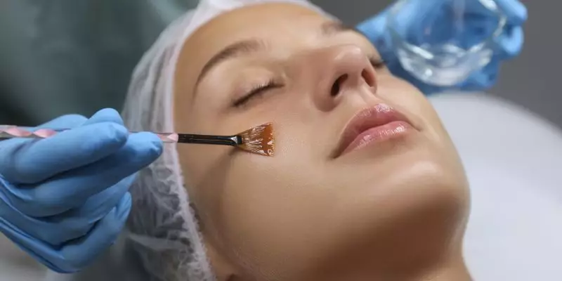 Chemical-Peel