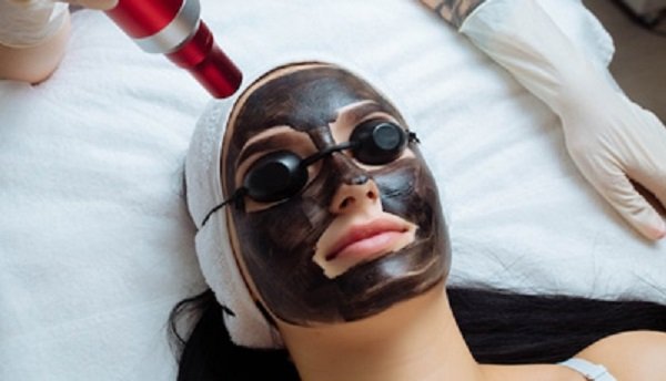 carbon-facial (1)